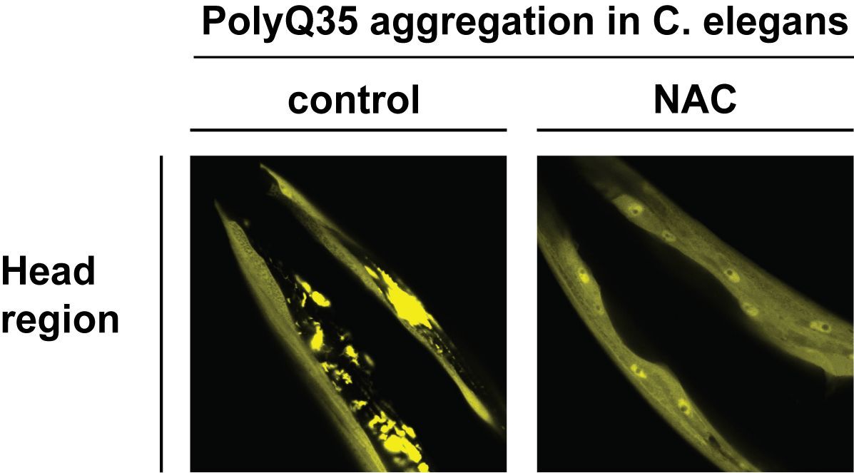 Die Aggregation von PolyQ-Proteinen bei C. elegans wird durch NAC unterbunden. Die Bilder zeigen die Kopfregion der Würmer, die ein Polyglutamin-haltiges Protein (PolyQ35) exprimieren, das in Verbindung mit Chorea Huntington steht. Überexpression von NAC beim Wurm (rechts) verhindert die Aggregation und Toxizität von PolyQ35. Copyright: Karina Gense